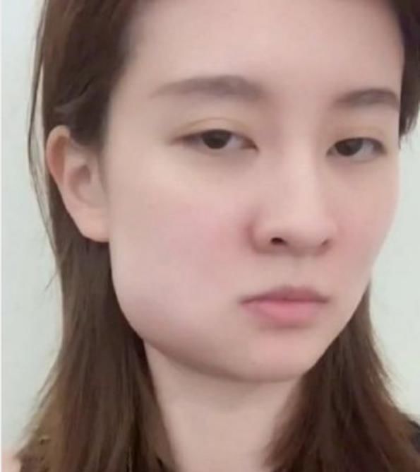 有一种整容叫拔牙，乔欣秒变小V脸，但她的改变才是最大的