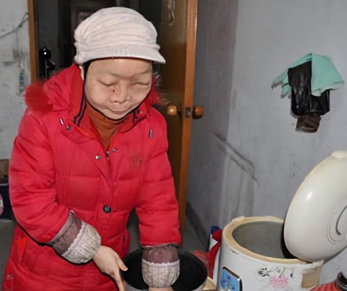 回顾"马面女孩"吴小燕:从小出门用布遮头,23岁"换脸"后重获新生